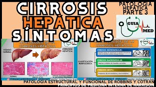 CIRROSIS HEPÁTICA SÍNTOMAS  GuiaMed [upl. by Virgie]