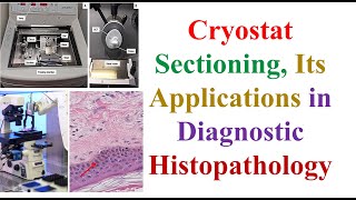 Cryostat Sectioning Its Applications in Diagnostic Histo 5th MLS HISTOTECHNOLOGY – 2 Cytology [upl. by Fi]