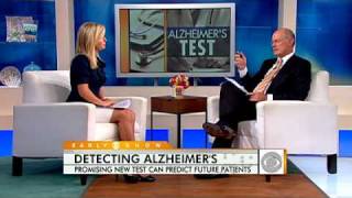 New Test May Predict Alzheimers [upl. by Udale]