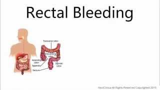 Rectal bleeding [upl. by Kalmick430]