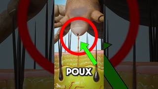 COMMENT VIVENT LES POUX SUR LA TÊTE 😰 shorts viral youtubeshorts [upl. by Yelbmik]