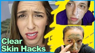 Clear Skin Hacks [upl. by Cutler]