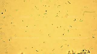 Group of little lactic acid bacteria are moving slowly under the microscope [upl. by Lleumas807]