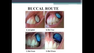 Buccal Route of Drug Administration  Advantages and Disadvantages [upl. by Astrahan415]