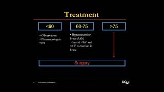 Scheuermann’s Kyphosis  Alekos Theologis MD on August 2 2024 [upl. by Rabassa726]