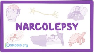 Narcolepsy NORD  causes symptoms diagnosis treatment pathology [upl. by Evadne]