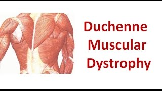 Duchenne Muscular Dystrophy [upl. by Ysak782]