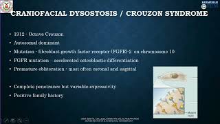 Crouzon Syndrome  Craniofacial Dysostosis Divya B  Department of oral Pathology amp Microbiology [upl. by Nosaj]