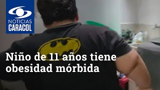 “Está en peligro de muerte” madre de niño de 11 años que tiene obesidad mórbida [upl. by Sifan]