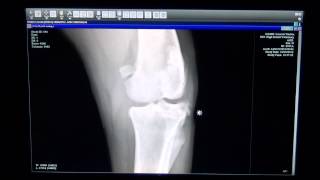 Dog with Torn ACL in Left Knee  High Desert Veterinary [upl. by Elad220]