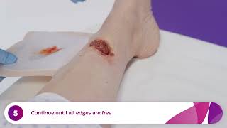 How to Apply and Remove Aquacel® Ag Foam Dressings Venous Leg Ulcer [upl. by Yerac]