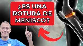 💡Cómo saber si sufres una Rotura de Menisco💥 [upl. by Ayeki]