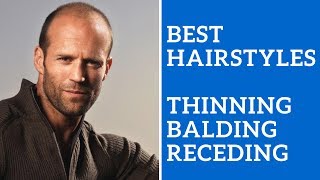 Best Mens Hairstyles for Thinning Hair Balding Hair or Receding Hair Line [upl. by Quita]