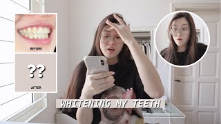 Professional TeethWhitening  Opalescence Boost StepbyStep with results [upl. by Nayarb12]