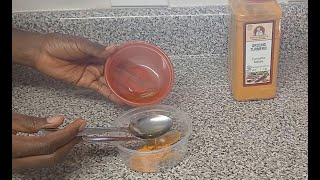 Natural remedy for dark spot remover and hyperpigmentation  MiatorV DIY [upl. by Eerok786]