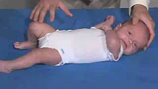 17Primitive Reflexes Asymmetric Tonic Neck [upl. by Ylen]