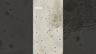 Flagellate Filter Feeding cell microscope music ponds life evolution [upl. by True236]