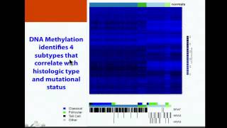 TCGA Papillary Thyroid Carcinoma Analysis  Thomas Giordano [upl. by Haorbed141]