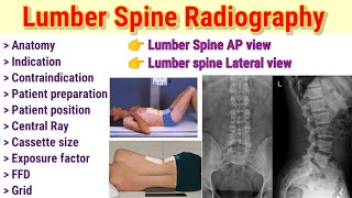 Lumber Spine Radiography lumber Spine AP view amp Lateral view Xray positioning spine xray [upl. by Gustave]