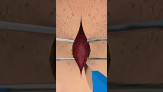 How Tracheotomy Tube Work short ytshorts  creativelearning3d [upl. by Sioux]