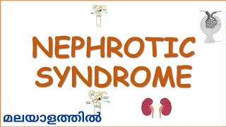 NEPHROTIC SYNDROME overview in Malayalam  Medical Surgical Nursing  Mr Nurse Manglish [upl. by Kinsler]