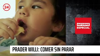 Informe Especial da a conocer el mundo del síndrome de Prader Willi  24 Horas TVN Chile [upl. by Budworth]