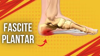 SAIBA TUDO SOBRE FASCITE PLANTAR [upl. by Tseng]