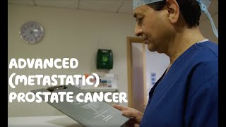 About Advanced Metastatic Prostate Cancer [upl. by Corly]