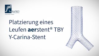 Platzierung eines Leufen aerstent® TBY [upl. by Avilo]