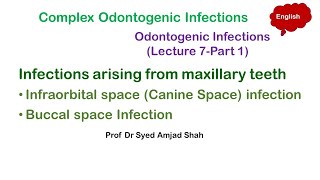 Infraorbital space  Canine Space  Buccal space Infection  Complex Odontogenic Infections [upl. by Nicolella]