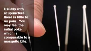 What Is Acupuncture [upl. by Welch]