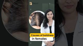 Causes of baldness in women  Hair fall treatment in Hyderabad  Dr Ravali Yalamanchili [upl. by Latrena]