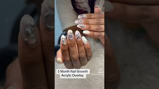 Acrylic Overlay Nail Growth over 5 Months nails nailart naildesign acrylicnails [upl. by Nnahteb]