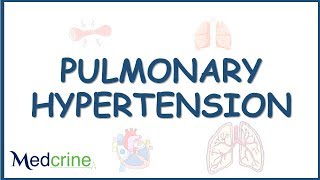 Pulmonary Hypertension causes pathophysiology diagnosis and treatment [upl. by Lenor]