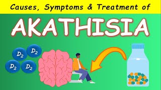 Akathisia by Antipsychotics  Causes Symptoms and Treatments [upl. by Krahling291]