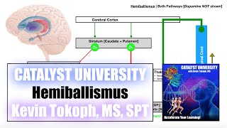 Hemiballismus  Pathogenesis SignsSymptoms and Detailed Mechanism [upl. by Haldi]