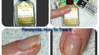 Acute Chronic PARONYCHIA Treatments [upl. by Ydennek]