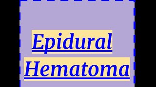 Epidural hematoma [upl. by Saire]