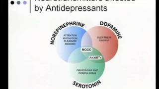 Medical Approach to Neuropathic Pain and Paresthesias [upl. by Jedlicka]