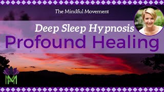 Use Your Powerful Mind Healing Deep Sleep Hypnosis  Mindful Movement [upl. by Nerad300]