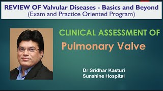 Clinical assessment of Pulmonary Stenosis and Regulation Dr Pragathi [upl. by Nagem]