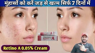 Retino A 005 Cream use dose benefits and side effects full review in hindi [upl. by Adnana]