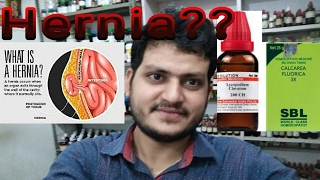 Hernia Homeopathic medicine for hernia explian [upl. by Ardnohsal]