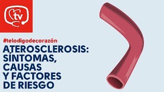 Aterosclerosis causas y factores de riesgo telodigodecorazón [upl. by Etsyrk923]