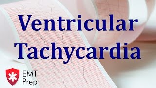 Ventricular Tachycardia ECG  EMTprepcom [upl. by Eryt]