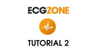 ECG Tutorial 2  Interpreting the ECG [upl. by Adnat]