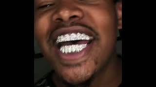 18k vvs clarity diamond honey comb setting permanent Gold grill Diamond Grillz Goldteeth [upl. by Airamasor160]