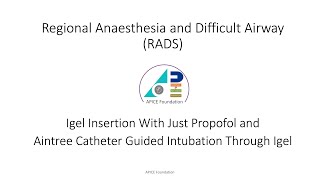 Supraglottic Airway Igel Insertion amp Aintree Guided Intubation [upl. by Euqinorev]