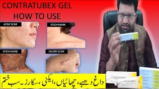 contractubex gel review  Acne scar removal cream  contractubex gel how to use  scar treatment gel [upl. by Robinette]