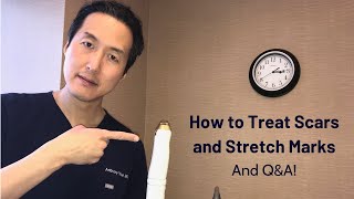 How to Treat Scars and Stretch Marks  Dr Anthony Youn [upl. by Dowdell]